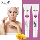 2 шт. крем от Акне против лица Лечение от прыщей, отбеливание крем контроль жирности тонкие поры удаление акне лица и угрей шрам уход за кожей