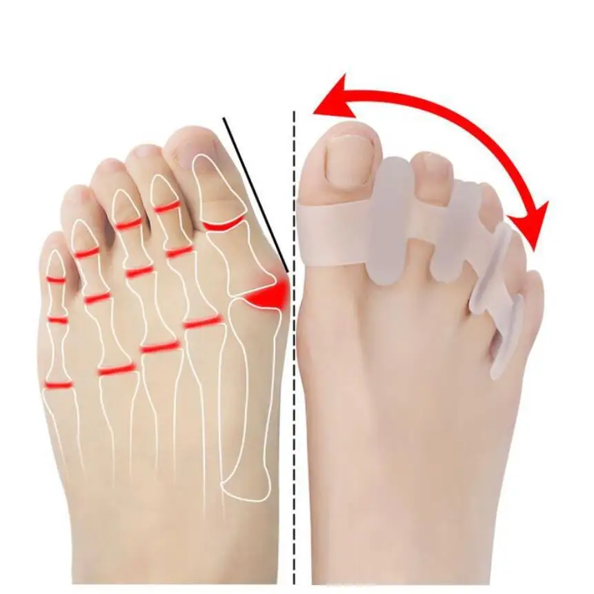 2 шт. ортопедический силиконовый корректор вальгусной деформации | Красота и