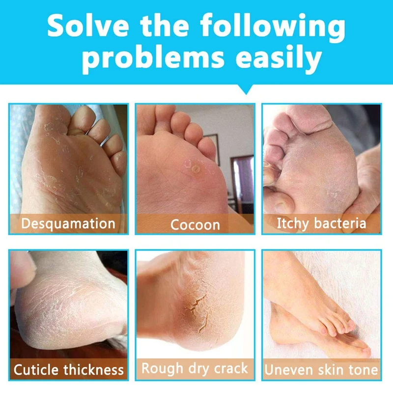 Aliver 4 упаковки детская пилинг для ног отшелушивающий Отшелушивающий мозоли