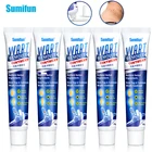 Антибактериальный крем для лечения бородавок Sumifun, 25 шт., устройство для удаление бородавок