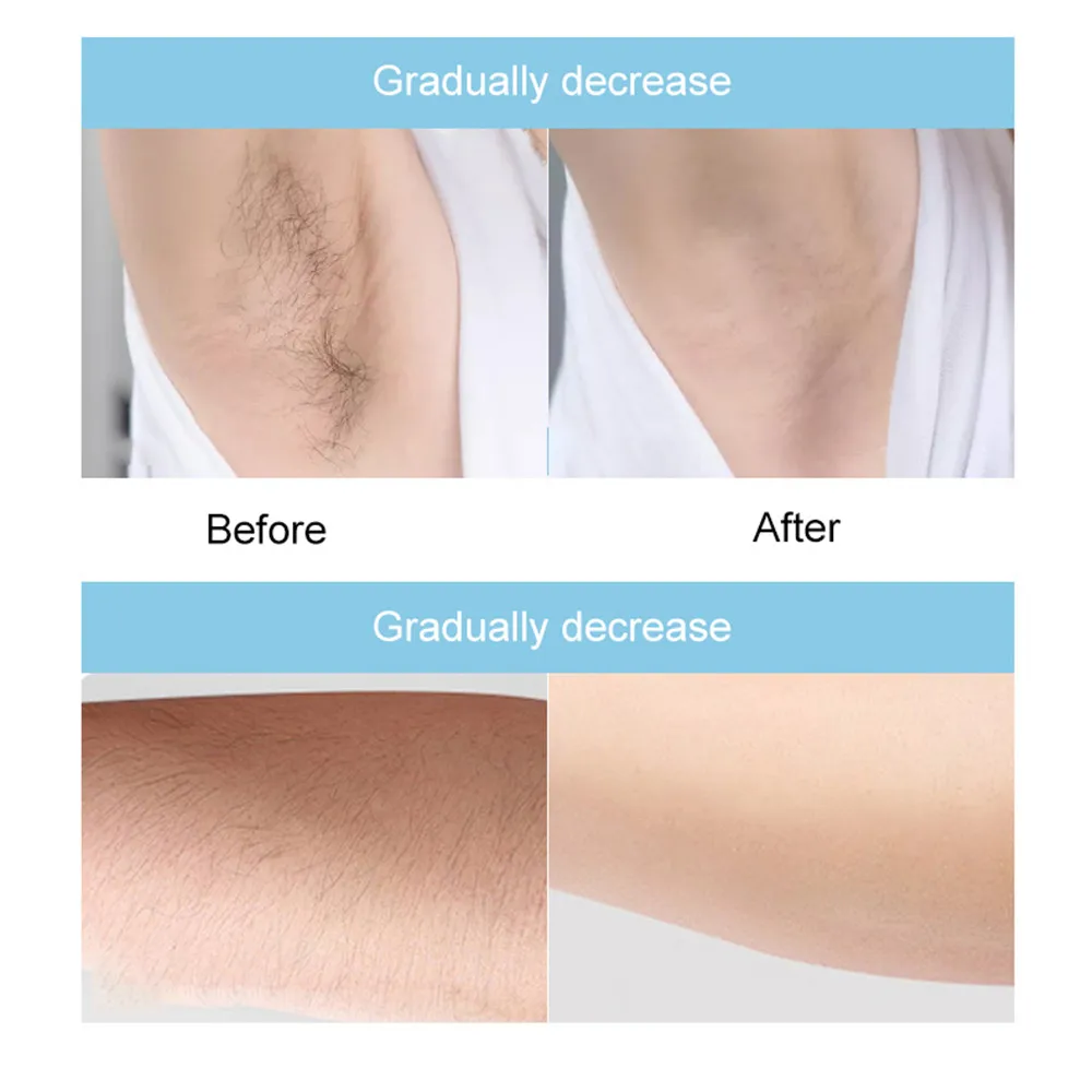 Электрический IPL лазерная эпиляция Эпилятор для удаления волос лазера диода Для