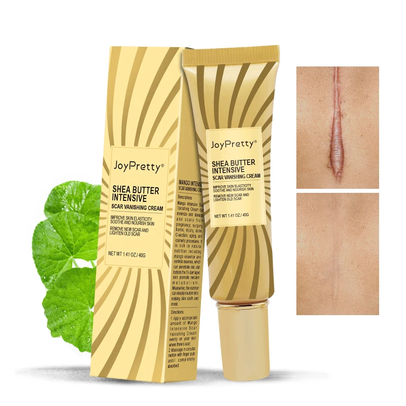 

JoyPretty 40g Acne Scar Removal Cream Pimples Stretch Marks Face Gel Remove Acne Smoothing Whitening Moisturizing Body Skin Care
