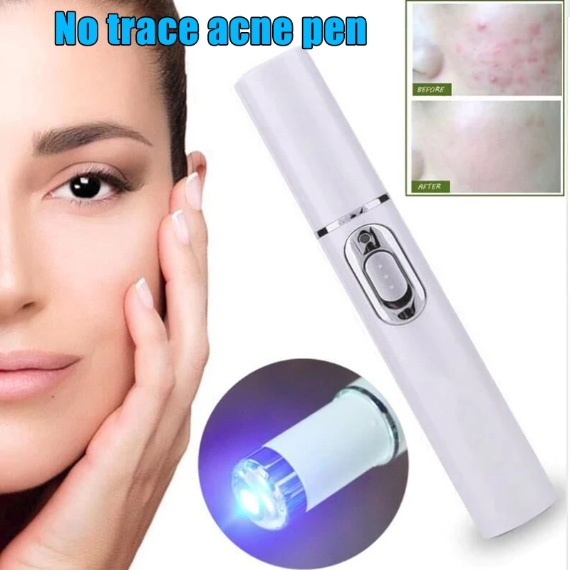 

Portable Blue Light Remove Acne Pen Wrinkle Removal Skin Care Tool SK88