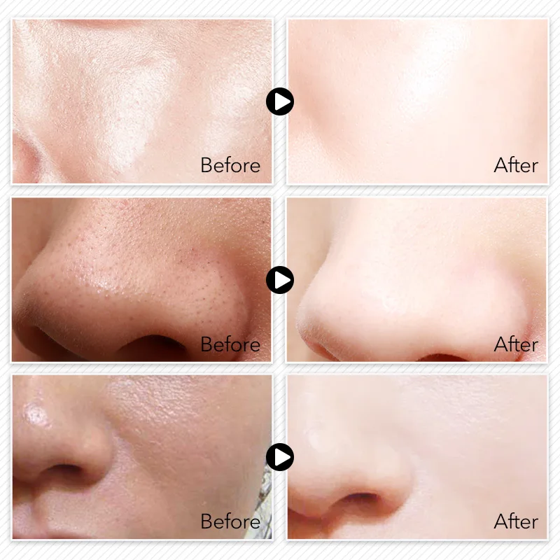 225 г Черная Очищающая маска для лица с газированными пузырями ухода за лицом