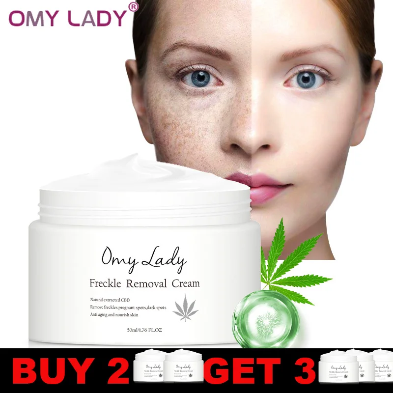 OMY LADY крем для удаления веснушек беременных меланин темное пятно Анти Старение