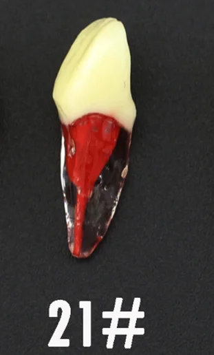 

21# (UL1 Central Incisor) Dental Study Model Endo Root Canal Teeth Study Practice Model Kilgore Nissin Type