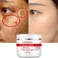 whitening freckle cream fade dark spots remove melasma melanin pigmentation remover brighten skin anti aging skin lightening 30g