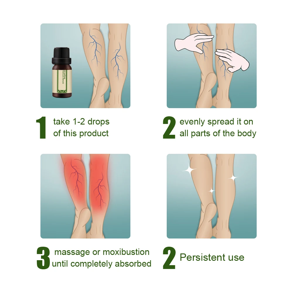 

All-Natural Vari-Cure Serum All-eelhoe Varicose Vein Treatment for Treatment Legs Care M2