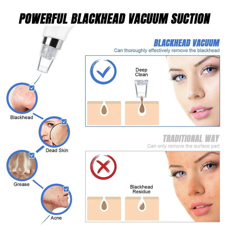 Черное очищающее средство от черных точек вакуумный уход за лицом для акне