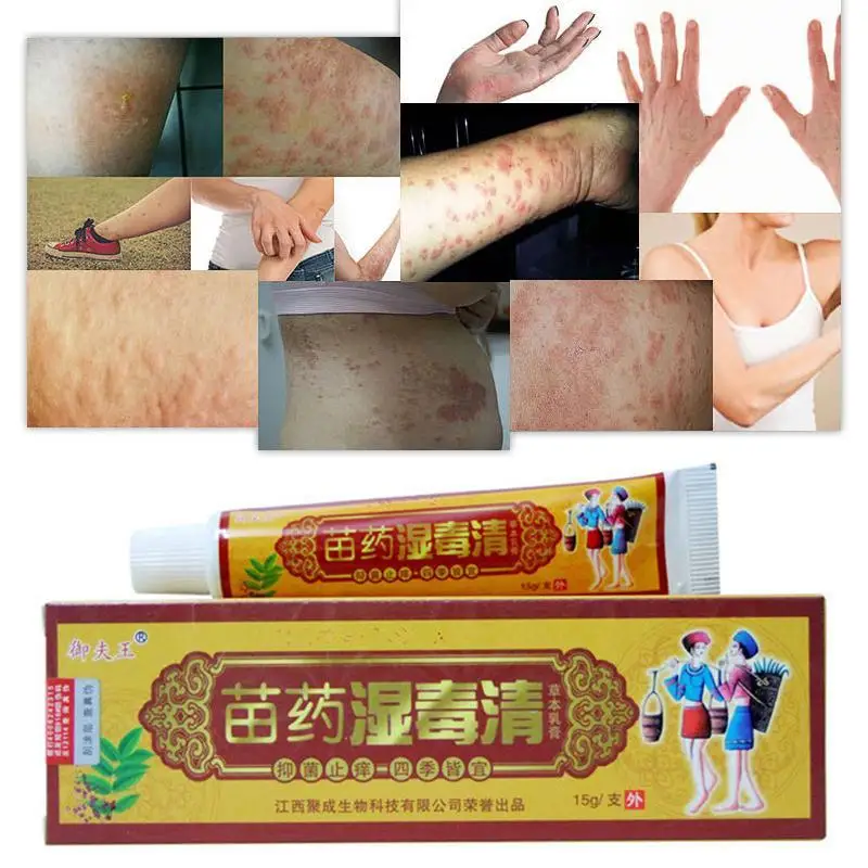 

Itching Ointment Herbal Cream Relieves Itching And Anti-inflammatory Psoriasis Dermatitis And Eczema Itching Skin Problem