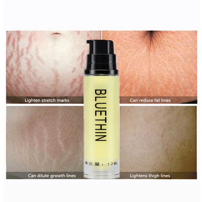 Крем против растяжек и шрамов не вызывающий раздражения| |