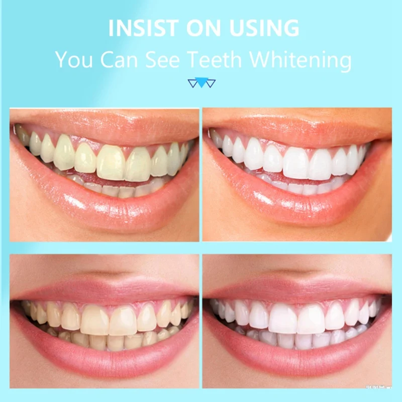 

Herbal probiotic tooth whitening powder removes plaque stains and keeps breath fresh and balanced oral flora oral care 50g