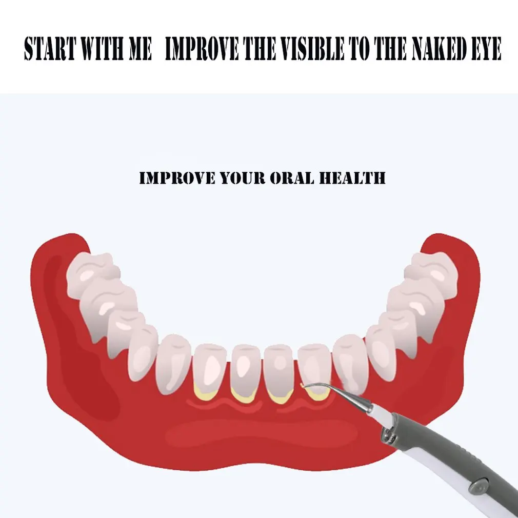 Новинка Электрический Ультра звуковой резчик для удаления зубных пятен зубной