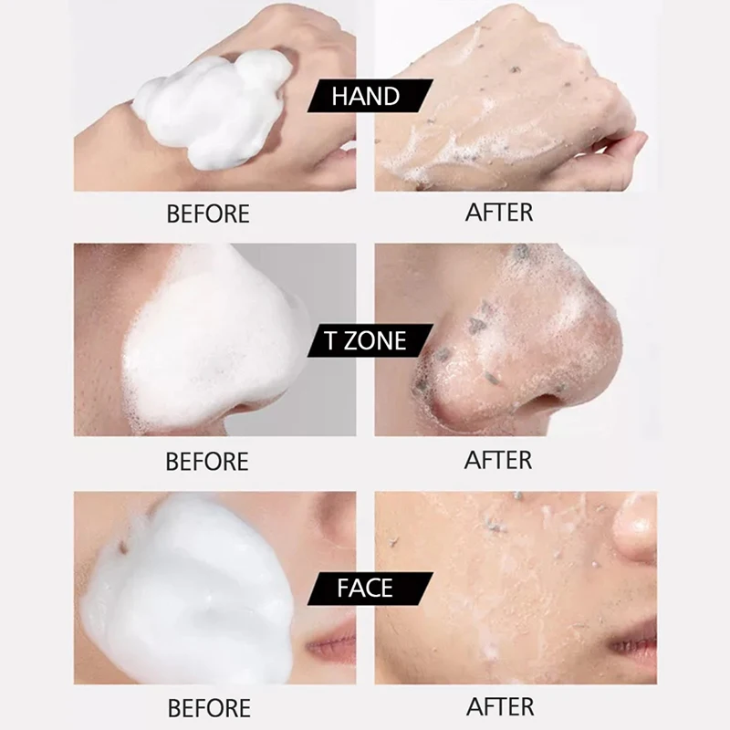 Facial Exfoliating Mousse Peeling Gel Face Scrub Deep Remove Cleaning All Skin Types Smooth Moisturizing Exfoliator Cream | Красота и