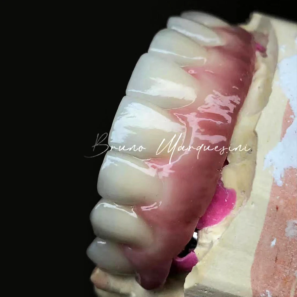 BAOT PFZ стоматологическая керамика циркониевый фарфоровый мини-набор VITA