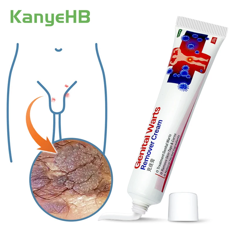 1pcs Wart Remover Cream Skin Tags Mole &amp Papillomas Treatment Private Parts Genital Antibacterial Ointment G006 | Красота и