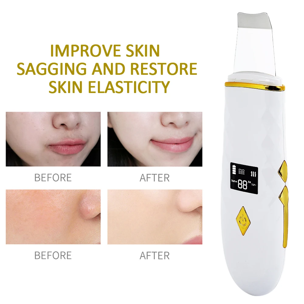 Ультразвуковая микродермабразия + нано пароварка Электрический пилинг Лопата