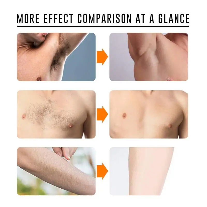 

10/20/30/50g Body Hair Removal Cream Beard Bikini Intimate Legs Body Armpit Painless Facial Hair Depilatory Cream TSLM2