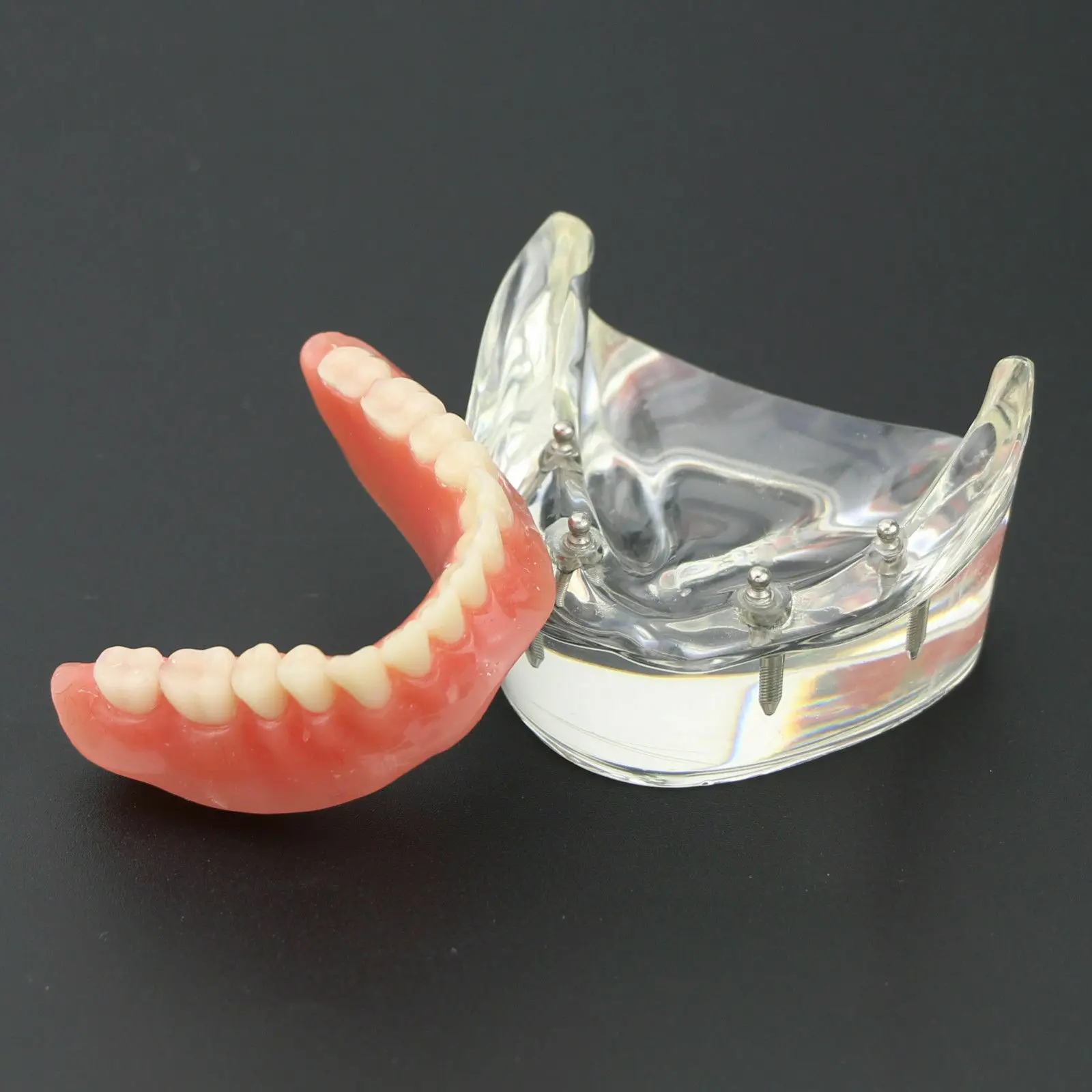 Dental Teeth Study Model Overdenture Inferior 4 Implant Demo Model 1PC