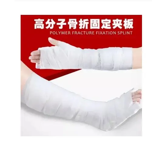 1 рулон/пакет медицинская ортопедическая отливка ленты высокого полимера