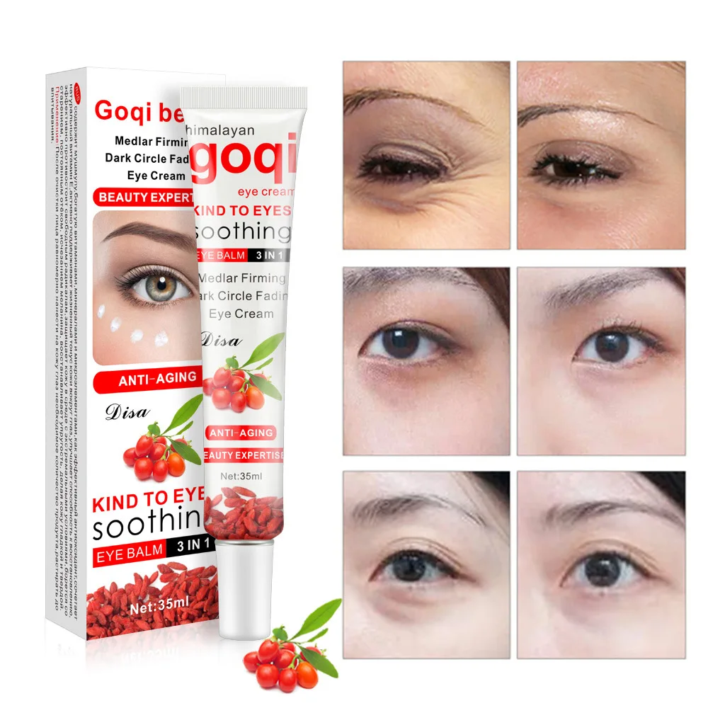 

Free Shipping Wolfberry Eye Cream Multi-Effect Repair Removes Dark Circles Tattoo Removal Dark Circle Removal Eye Care Skin Care