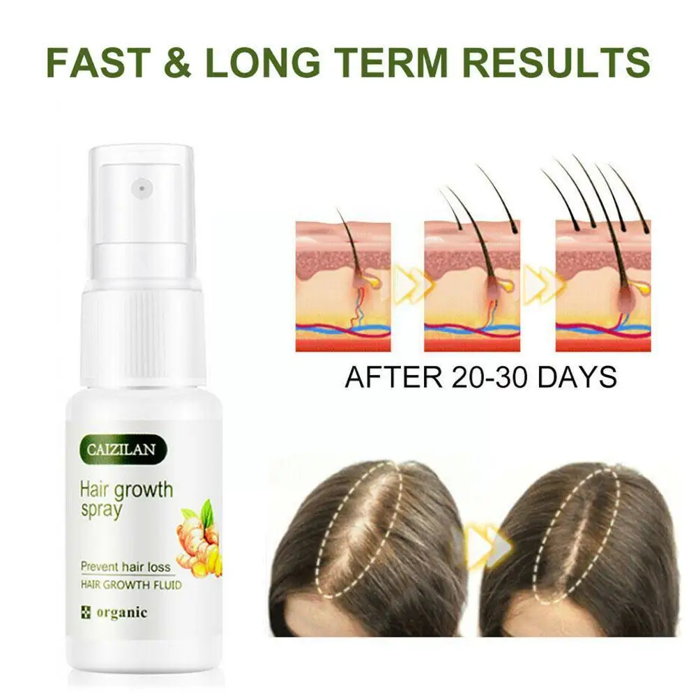 

Ginger Nutrition Liquid Ginger Hair Root Spray 20ml Products Conditioner Natural Spray Repair Hair Hair Hair Care Damaged H Z7D5