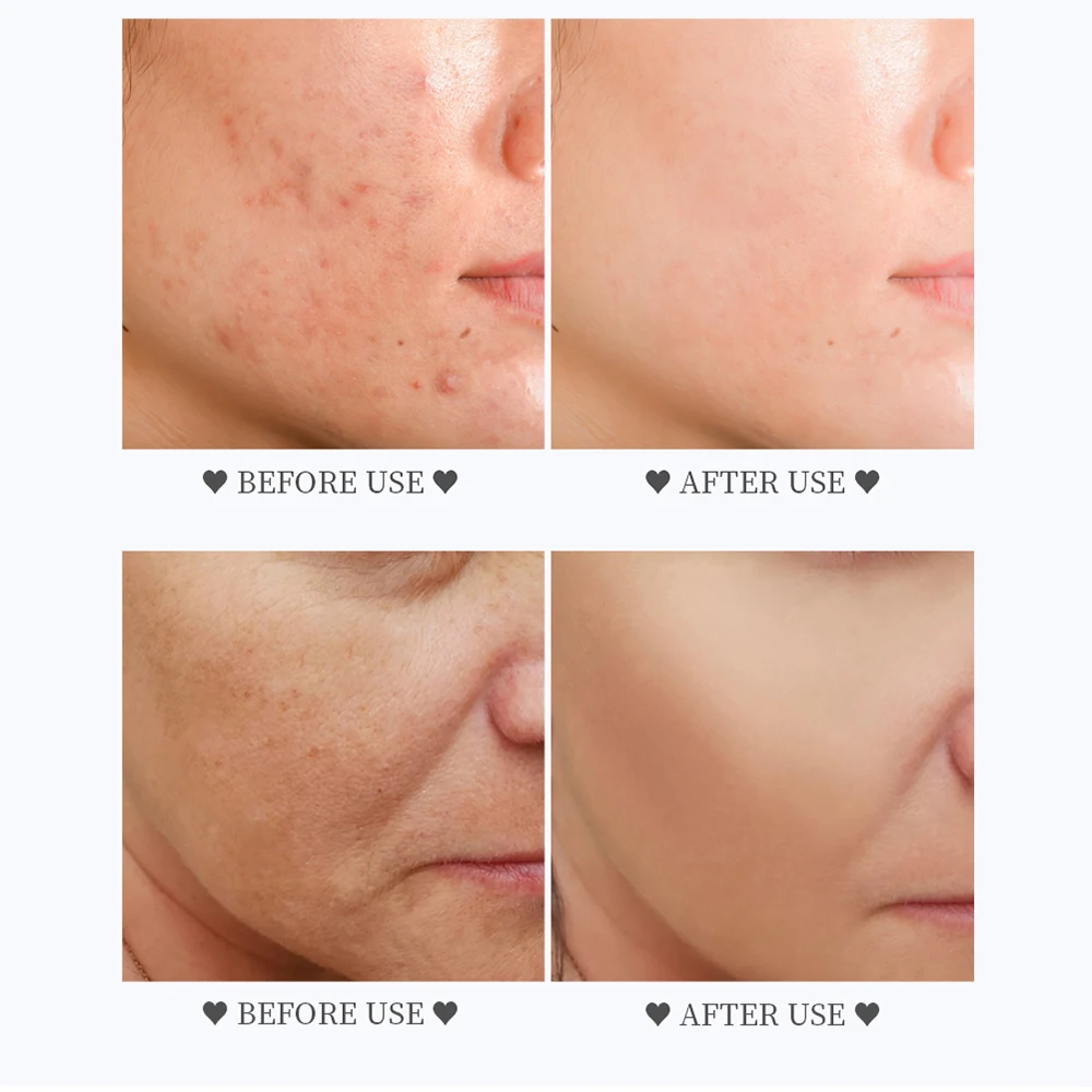 Яркая Гламурная кожа отбеливающая увлажняющая выцветает с мелкими линиями