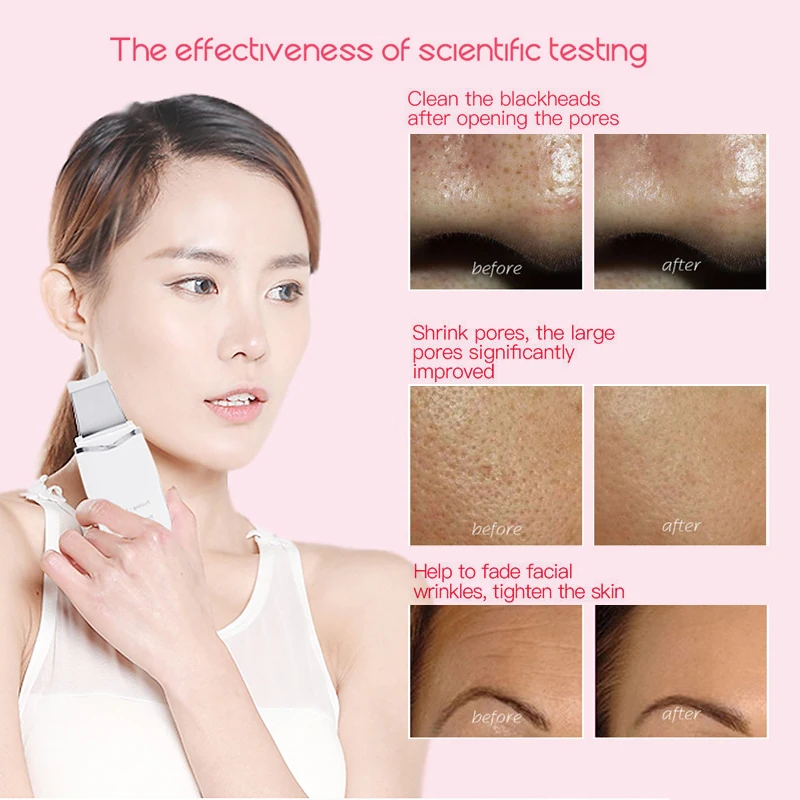 Ultrasonic Face Skin Scrubber Facial Cleaner Rechargeable Peeling Vibration Blackhead Removal Exfoliating Pore Cleaner Tools
