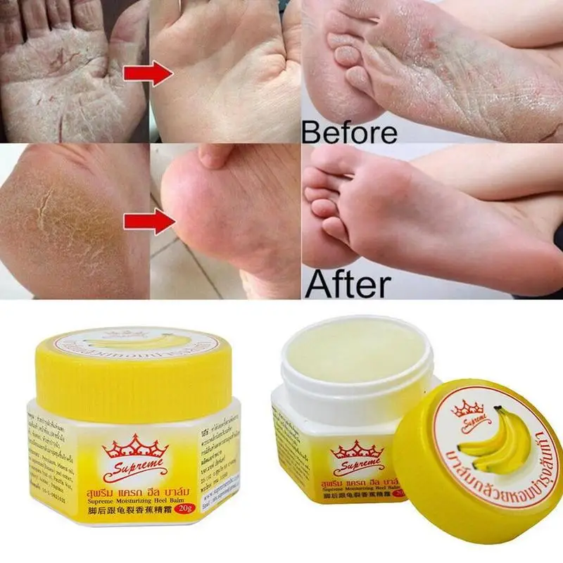 Thailand Banana Anti-chapping Repair Heel Cream Moisturizing Prevent Dry Crack Ointment Foot Care Relief Smooth Skin |