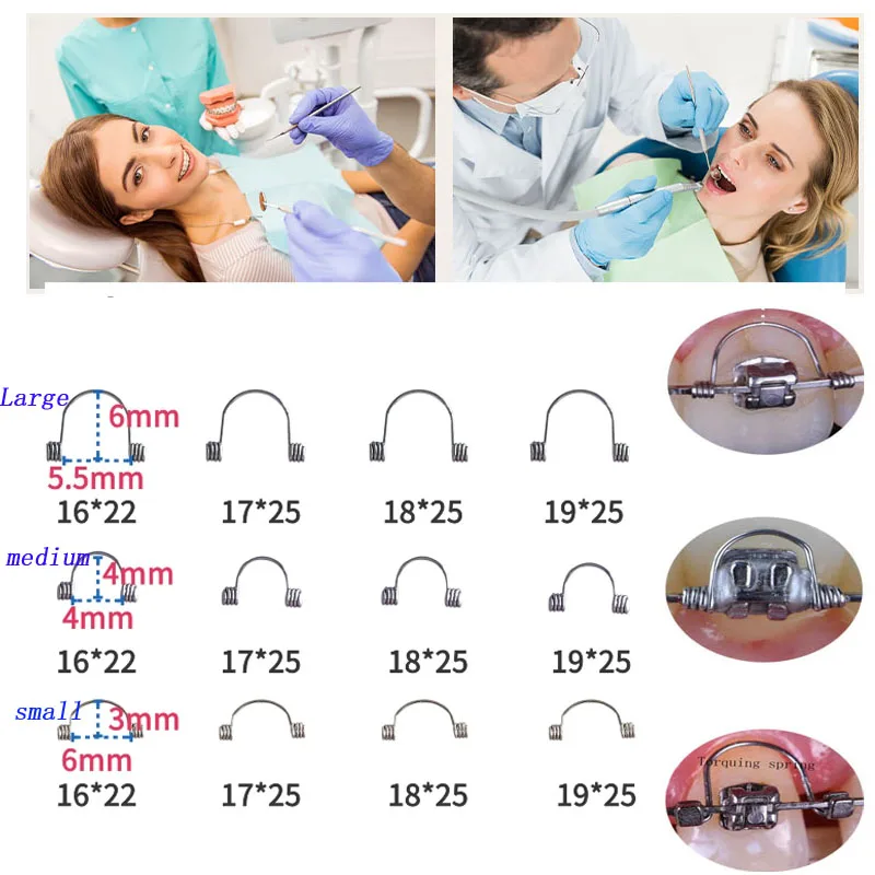 30Pcs/Lot  Dental Orthodontic Torquing Spring Single Anterior Teeth Torque Rectangular Spring Use with Orthodontic Ligation Wire