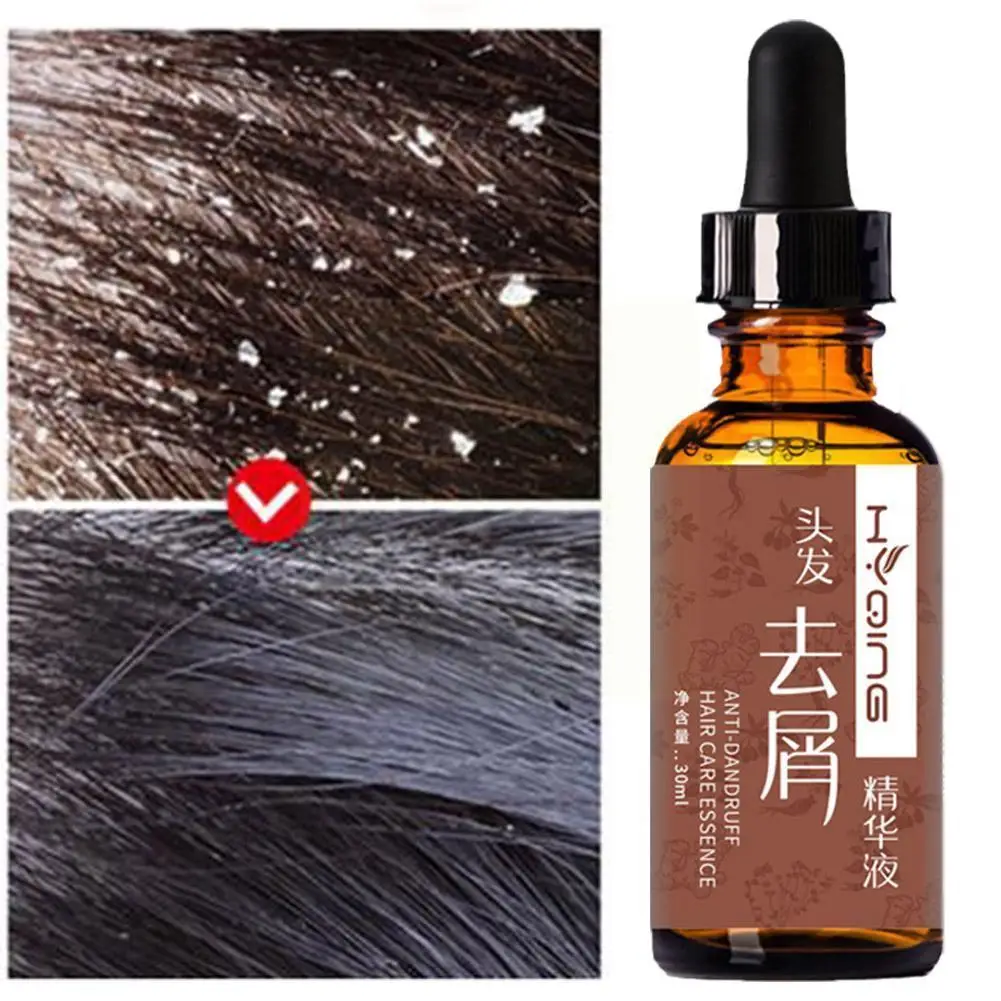 

30ml Anti-dandruff And Itch Removing Hair Essential Repair Hair Nourishing Oil Moisturizing Care Hair Z4F7