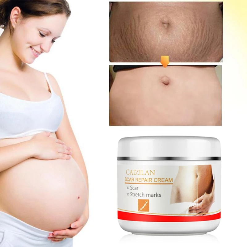 30g Acne Scar Stretch Marks Repair Cream Removal Spots Blackhead Whitening Skin For Scald Marks Skin Smoothing Scar Repair Cream