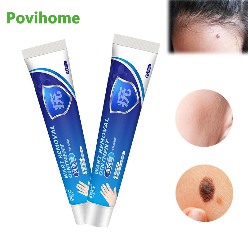 

1/3/5pcs Wart Remover Ointment Herbal Extract Medical Plaster Antibacterial Warts Ointment Treat Mole Cream Skin Tag Removal