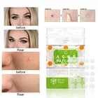 24 шт., невидимые пластыри от прыщей и акне