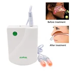 Низкочастотное устройство для лечения ринита, устройство для массажа носа, лечение синусита, лазерное лечение, снятие боли, массажер для носа, забота о здоровье