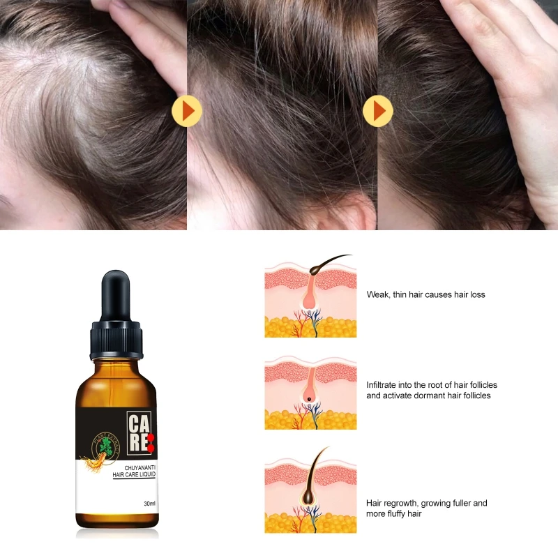 Сыворотка для волос Ginger Strong консолидирует корни ингибирует секрецию масла кожи