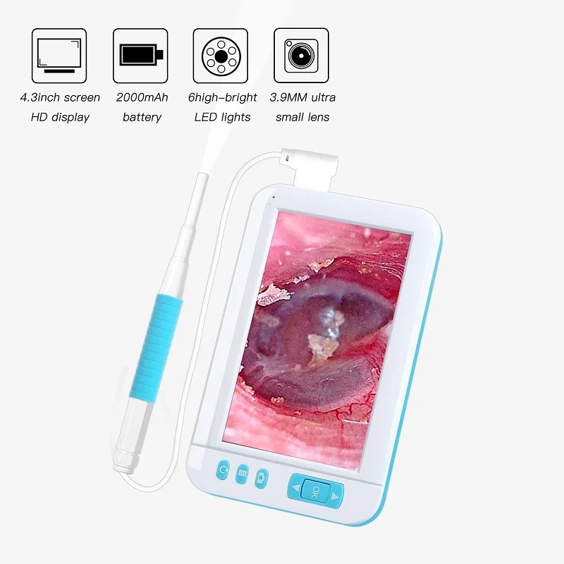 Эндоскоп HD 1080p 4 3 дюймовый Hd Tft Ips schem камера Otoscopio Digitale ушной монитор|Камеры
