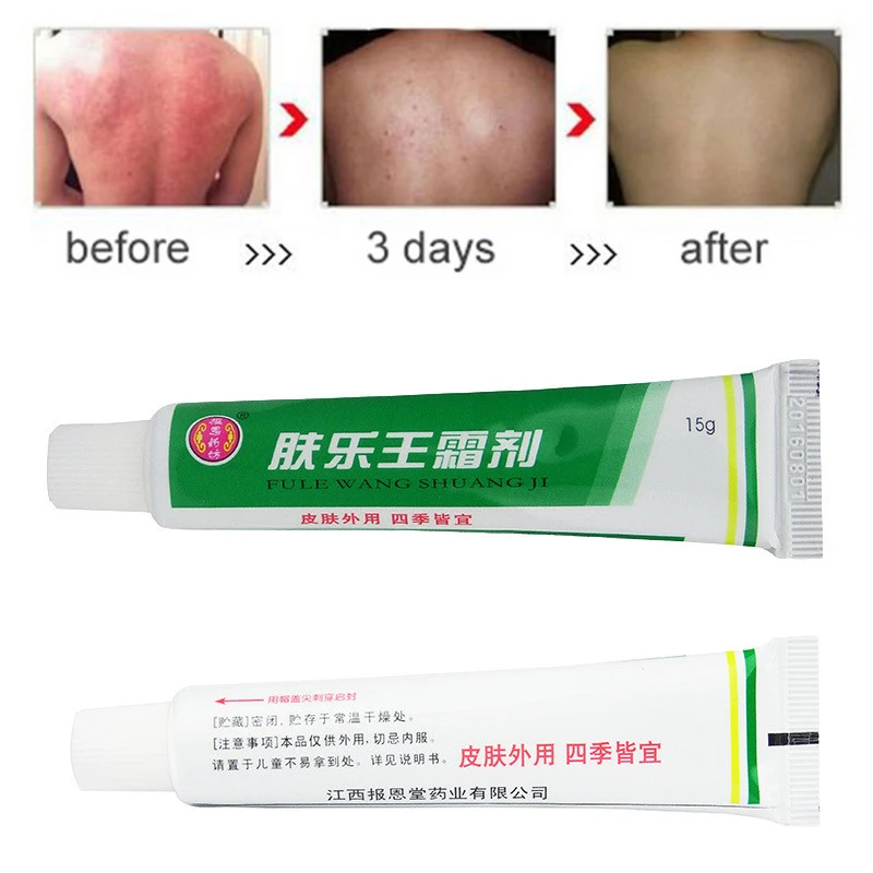 

10pcs FULEWANG Skin Psoriasis Cream Dermatitis Eczematoid Eczema Ointment Treatment
