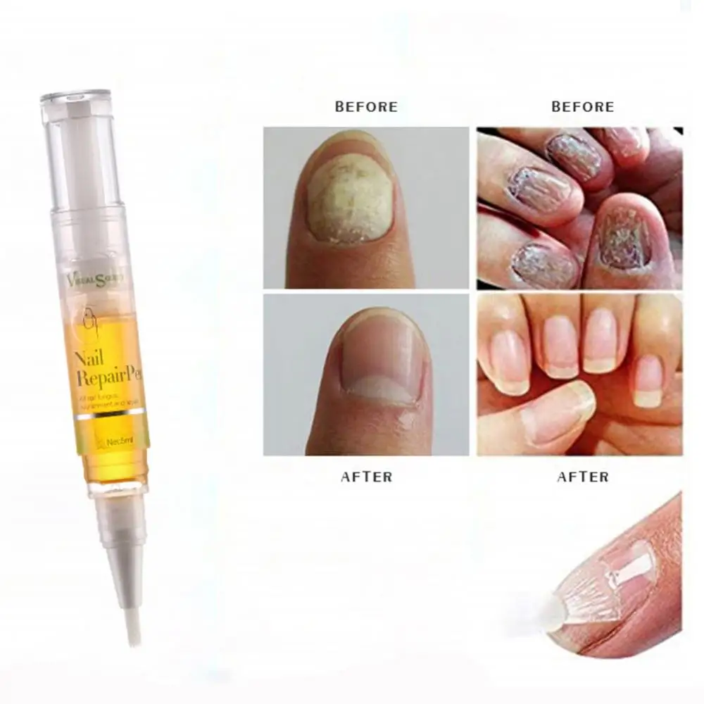 5 мл жидкая восстанавливающая эссенция для ногтей Уход за ногтями снятие