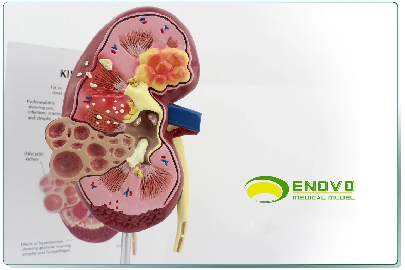 Anatomical model of human kidney