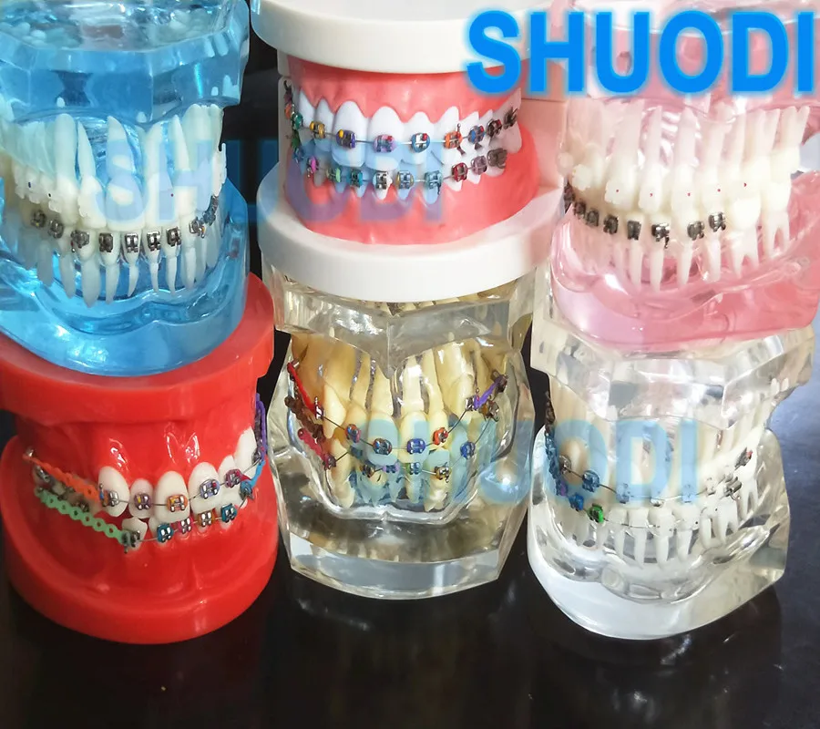 1 шт. Стоматологическая Ортодонтическая модель для ухода за полостью рта |