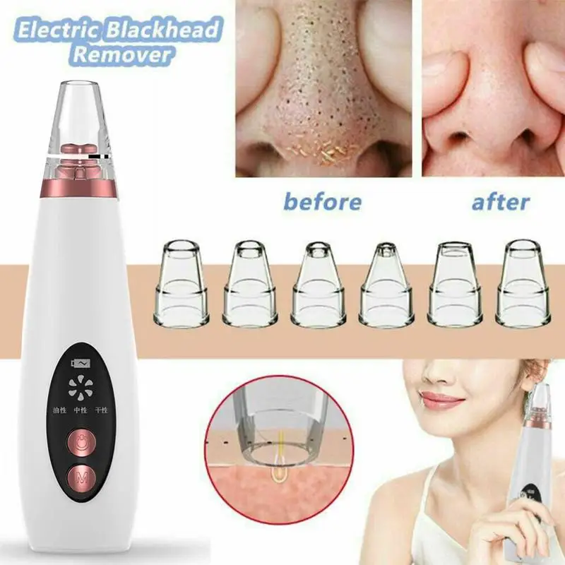 

Blackhead Remover Ultrasonic Vibration Pore Cleaner Face Vacuum Skin Care Acne Pimple Removal Vacuum Suction Tools