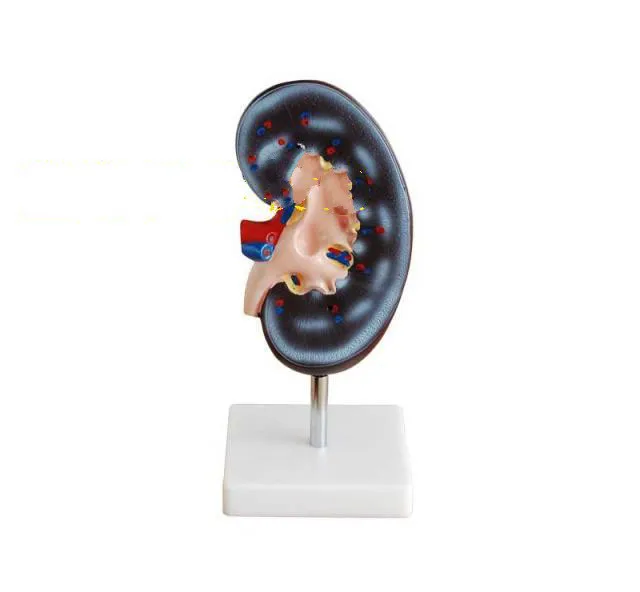 2X Enlarged Renal Anatomy Model The Anatomical of Human Kidney Amplification Medical Teaching Supplies | Канцтовары для офиса и