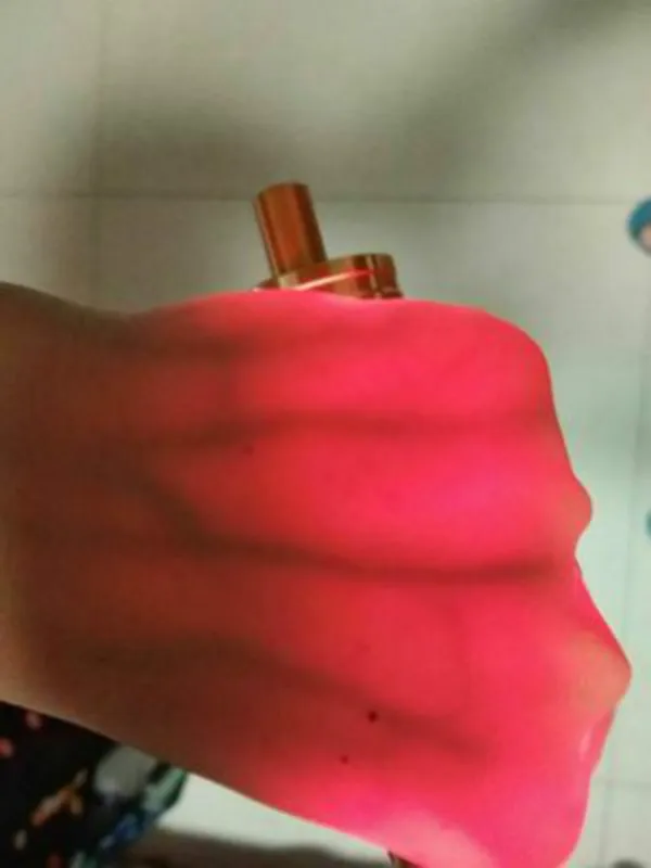 Характеристическая вязкость полимера вены просмотра 6 медицинская визуализация