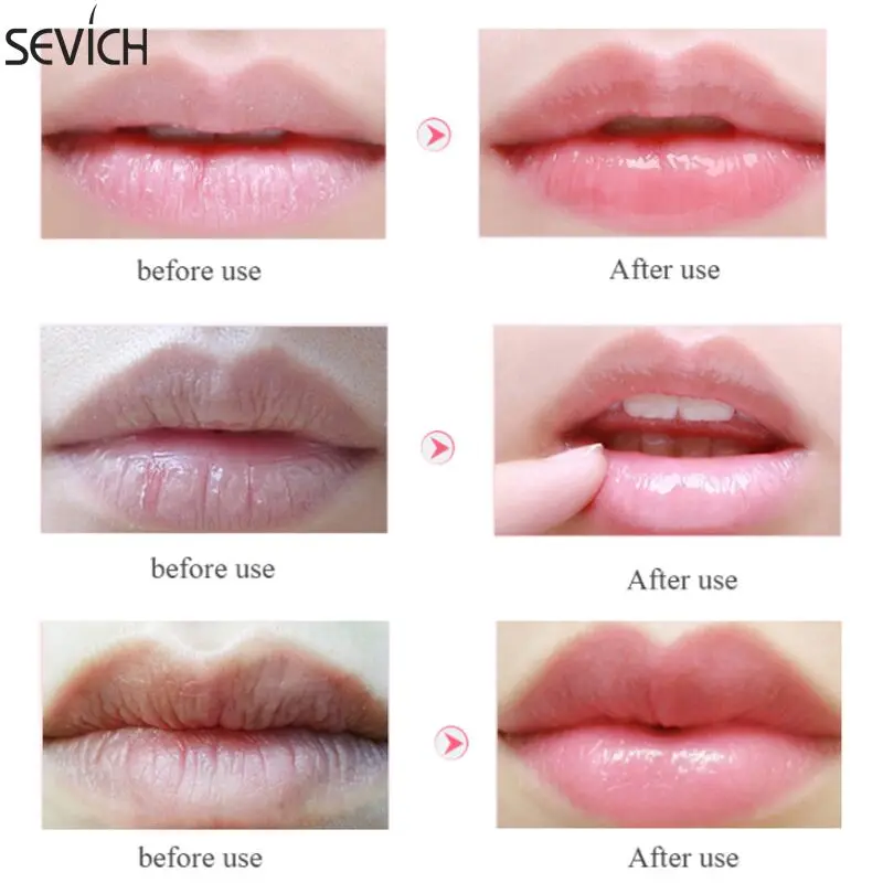 Sevich Collagen Lip Mask Plumper Repairing Reduce Moisture Essence Anti Ageing Wrinkle Patch Pad Gel | Красота и здоровье