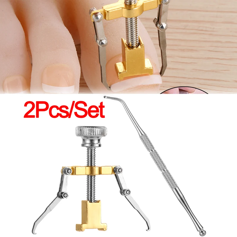 Вросшие ногти палец ноги коррекция ногтей крепёжные приспособления для педикюра