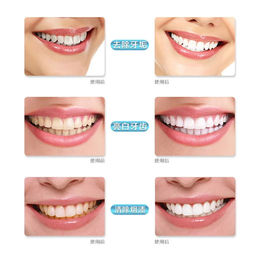 Стоматологическое лабораторное оборудование для зубов система отбеливания 44%