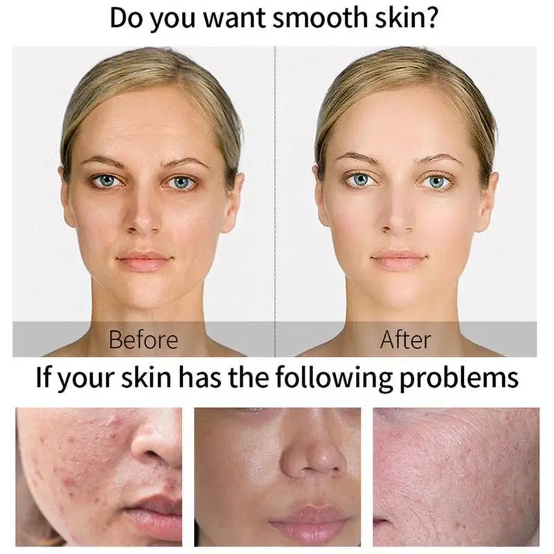 

30ml Lactobionic Acid Essence Moisturizing Original Liquid Pores Minimizes Care Enlarged Blackhead Anti-Aging Reduces L1C9