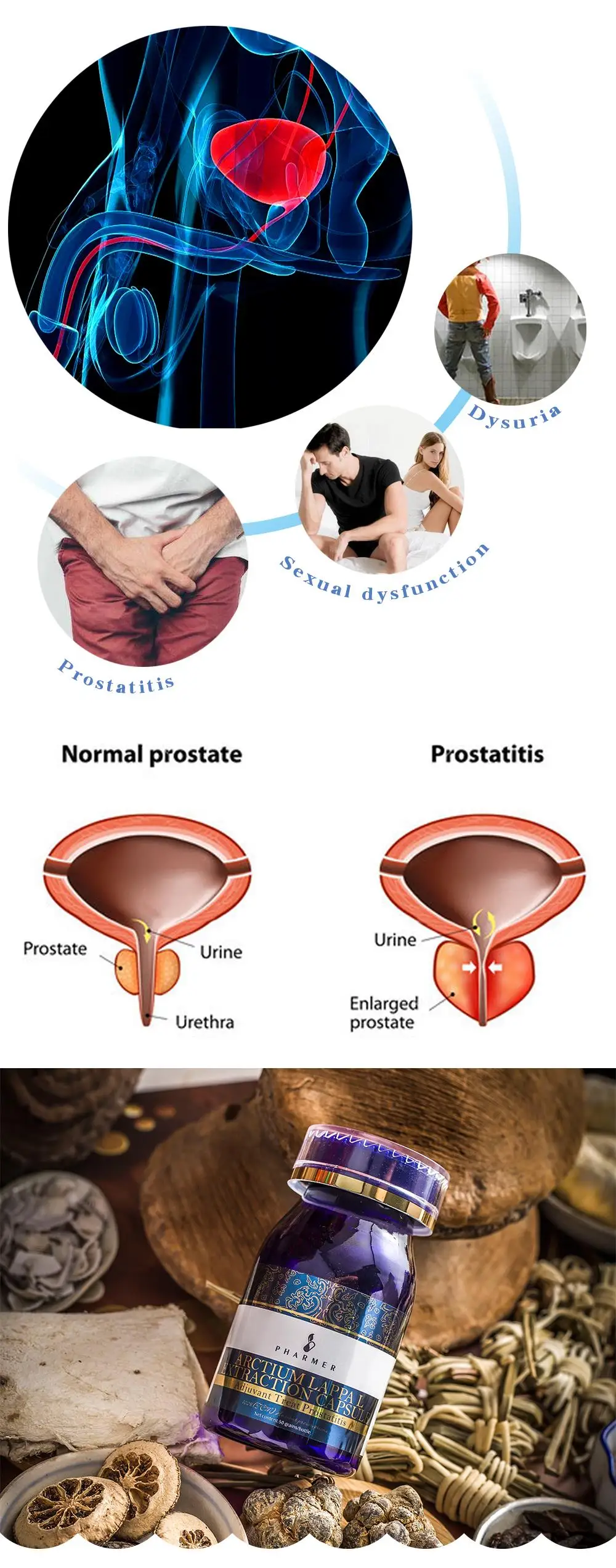Pharmer Arctium Lappa L экстракционная капсула, Adjuvant лечение простатита, лечение гипертрофии простаты, сексуальная дисфункция, 50 шт