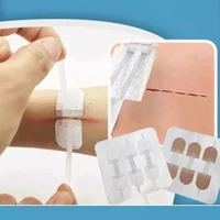 3 pcsset zipper band aid wound closure patch hemostatic patch wound fast suture zipper band aid outdoor portable 70 22mm